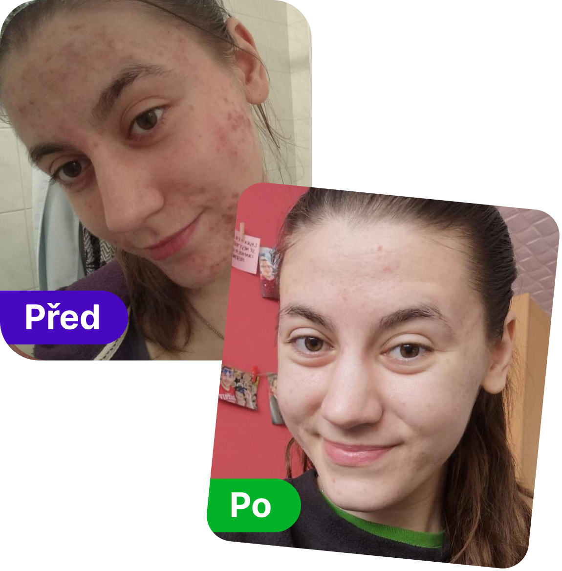 Pleť před a po použití FaceDeluxe